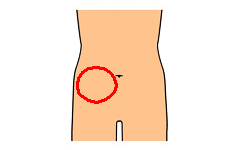右側の下腹部の痛み