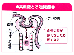 高血糖とろ過機能