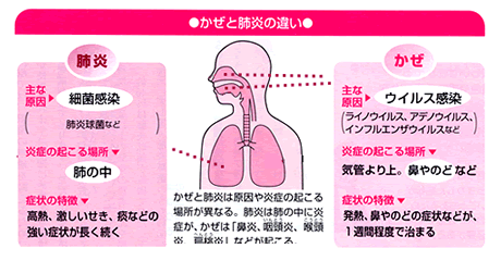 かぜと肺炎の違い