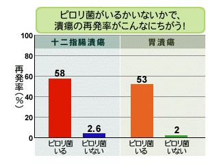 ピロリ菌がいるかいないかで、潰瘍の再発率がこんなにちがう！