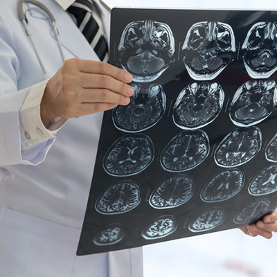 MRI・CT・レントゲンは年に何回受けても大丈夫？