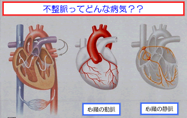 不整脈