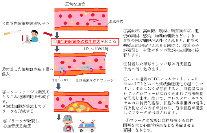 脂質異常症 | 健診・人間ドックで要精密検査・要診察（治療）有の方